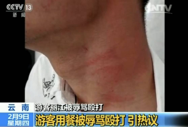 游客麗江就餐被辱罵毆打 真相到底是什么？