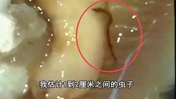 一只生蠔引起的冤案，觸動了餐飲人的“麻木神經(jīng)”